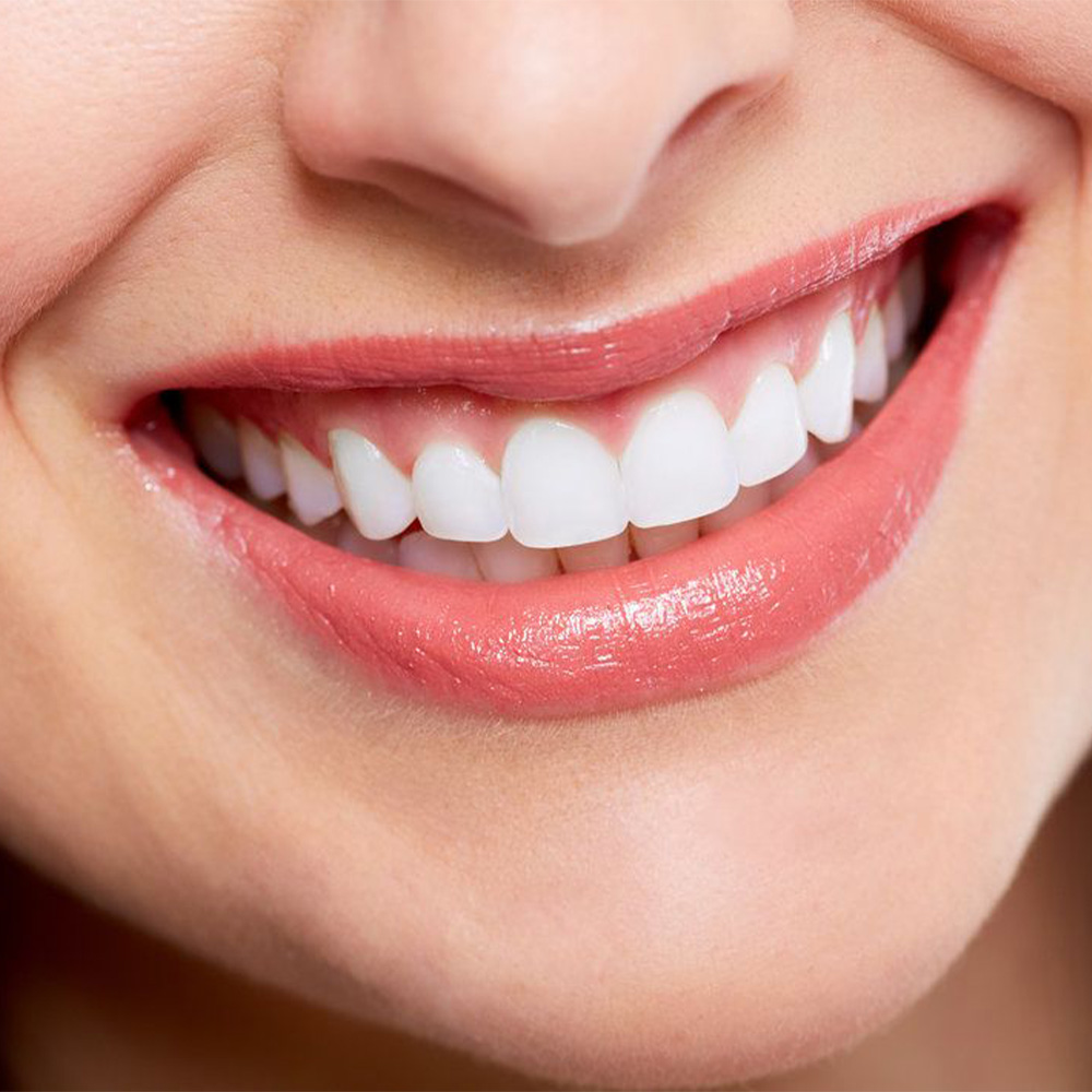 https://dentalart.al/wp-content/uploads/2024/06/smile-makeover.jpg